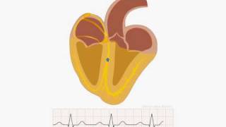 Animation of normal sinus rhythm