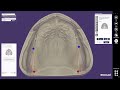 exocad video tutorial full denture design unimdent cad cam s design exocad unimdent dentalcad