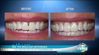 Self-Conscious About Your Teeth? | Transform Your Smile with Cutting Edge Alternative to Porcelain V