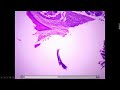 histology of spleen thymus lymph node and tonsil