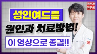 성인여드름 '이것'만 알면 해결 할 수 있습니다! 피부과 전문의가 알려주는 꿀팁대방출!