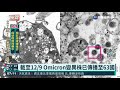 omicron比delta易傳染 引發症狀較輕微｜華視新聞 20211213