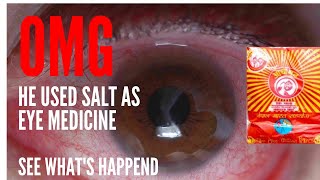 I put salt in my eyes for ocular problems, आँखा मा नुन हाल्दा को परिडाम