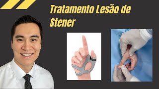 Treatment of Stener's Lesion