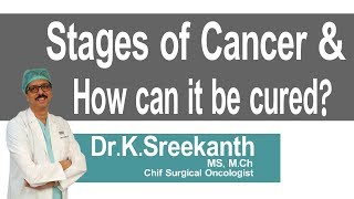 Hi9 | Stages of  cancer \u0026 How can it be cured? | Dr.K.Sreekanth | Surgical Oncologist