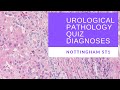 Urological Pathology Quiz - Diagnoses