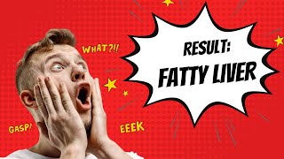 Diagnosed with Fatty Liver ? Tips to prevent and reverse Fatty Liver! #health  #healthy  #lifestyle