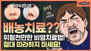 [비전문회담_Clip] 위험천만한  배농치료 효과?? 콧물빼기(면봉,이쑤시개) 절대 따라하면 안됩니다! 방구석 비염치료 미신?!