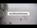 Hoofdluis herkennen