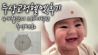 사두,단두교정 | 헬멧내돈내산솔직후기 | 아기두상교정하기 | 헬멧장단점 | 헬멧관리꿀팁 | 헬멧할인받기 | 헬멧두상수치변화 | 아기짱구두상만들기 | 하니헬멧 | 하니헬멧추천인코드