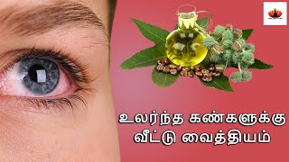 உலர்ந்த கண்களுக்கு வீட்டு வைத்தியம் | Home Remedies for Dry Eyes in Tamil | Tamil Health Tips