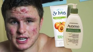14 Weeks Into Accutane | RESULTS, PRODUCTS & GYM STORY
