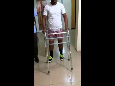 Bilateral Above Knee Prosthetic Rehabilitation - YouTube