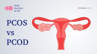 PCOD vs PCOS Know the Difference!  | Birla Fertility & IVF