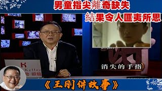 王剛講故事 第301期：消失的手指：男童指尖離奇缺失，結果令人匪夷所思。