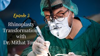 Rhinoplasty Transformations with Dr. Mithat Topal Episode: 3