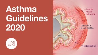 Asthma Guidelines Update 2020 - Diagnosis and Management