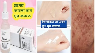 The Ordinary Niacinamide 10% Zinc 1% Sarum Full Honest Review | ব্রণের দাগ দূর করতে সবচেয়ে উপকারী