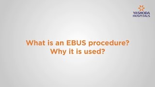 EBUS ( Endobronchial Ultrasound Bronchoscopy ) : Advanced Technology to Diagnose Lung Diseases