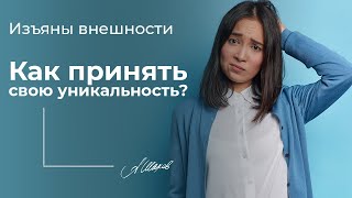 Изъяны внешности. КАК ПРИНЯТЬ СВОЮ УНИКАЛЬНОСТЬ?