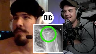 Colt Fake Explains His Mindset and Worst  BMX Injury