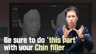 [HUSHU]Chain filler - Be sure to do'this part' with your chin filler!