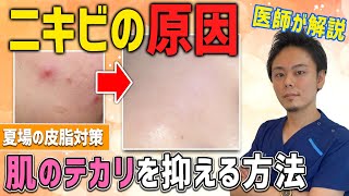 【医師が教える】肌のテカリを抑える方法!!ニキビの原因を撃退!!【スキンケア】