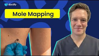 How Mole Mapping Can Help Save Your Life