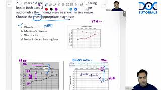 ENT Most Important Questions Discussion For FMGE Jan 2025 By Dr Rajiv Dhawan