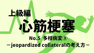 【心電図】心筋梗塞上級編 No.5 多枝病変③ jeopardized collateralの考え方！