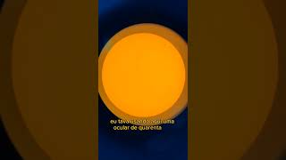 Apontei o Telescópio para o Sol - Manchas Solares #shorts #astronomia