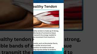 Most tendon injuries fall into two categories: Tendinitis and tendinosis