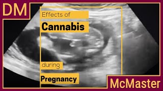 What Effect Does Cannabis Use Have During Pregnancy?