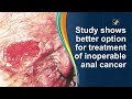 Study shows better option for treatment of inoperable anal cancer