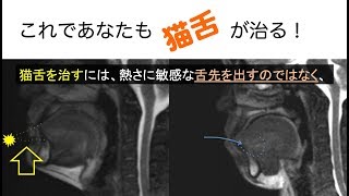 猫舌の治しかた（MRIの動画で解説）