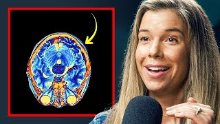 Brain Fog Sucks. Here's How To Get Rid Of it - Dr. Rhonda Patrick