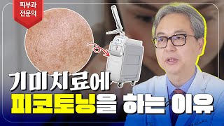 피부과 전문의가 기미제거에 피코토닝을 추천하는 이유!