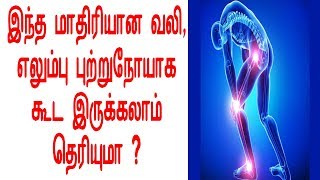 இந்த வலி, எலும்பு புற்றுநோயாக கூட இருக்கலாம் தெரியுமா ?