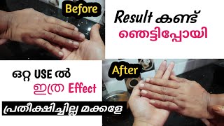 ജീവിതത്തിൽ  ആദ്യമായി JAPANESE Skin  WHITENING secret പരീക്ഷിച്ചപ്പോൾ | dearlekshmi