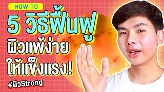 5 วิธีฟื้นฟูผิวแพ้ง่าย ผิวระคายเคือง ผิวบอบบางให้แข็งแรง แบบเห็นผล !!  | นุชา HAPPY NUCHA