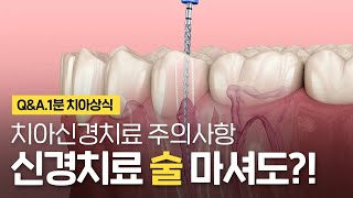 치아 신경치료 술 음주 무조건 안된다? 신경치료 주의사항 ⏰1분 치아상식