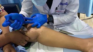 តើការព្យបាលដោយ Prolotherapy គឺជាអ្វីសម្រាប់ជំងឺសន្លាក់? ដោយលោកវេជ្ជបណ្ឌិត ម៉ែន ស្រៀង