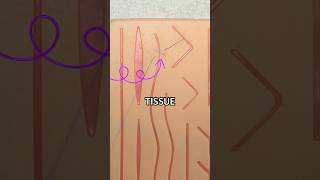 The Figure of Eight Stitch #howto #surgery #stitches #suturing #medicine