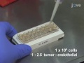 a real time technique to measure invasion of endothelial cell monolayer by cancer cells