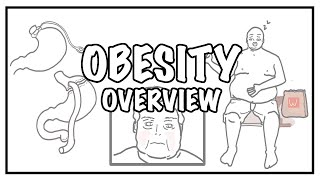 Approach to OBESITY and Weight gain - causes, risk factors, BMI, complications and treatment