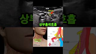 정상호흡패턴이 악화되는 이유 #횡격막