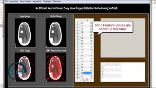 An Efficient Keypoint based Copy Move Forgery Detection Method using MATLAB