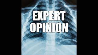 Expert Opinion HD