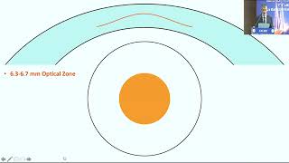 AIOC2022 - IC532 - SMILE/ LASIK/ PRK or Phakic Lens? Selecting the best procedur...Dr Gaurav Luthra