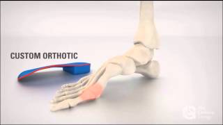 Biomechanix Clinic Ltd - Hallux Rigidus